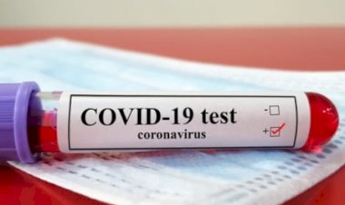 Belize ve Kosta Rika ABD seyahati için yeni CDC şartına yanıt geldi